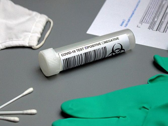 Rusiyada koronavirusdan ölənlərin sayı 292 nəfər artdı