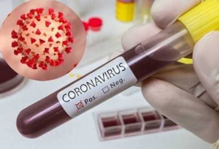 Koronavirus hər saatda təxminən 17 iranlını öldürür