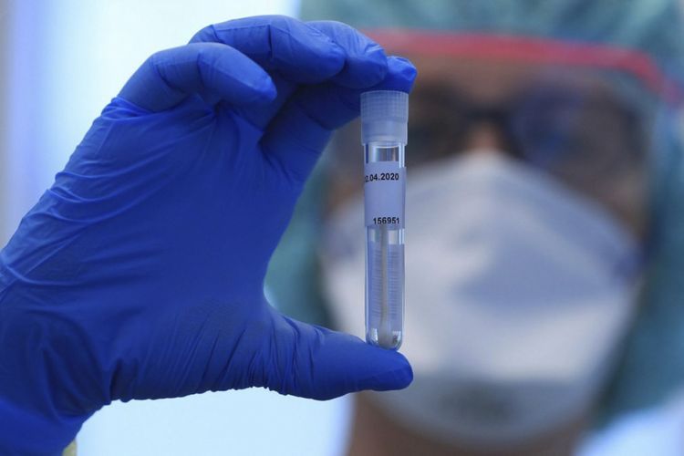 Gürcüstanda son sutkada koronavirusdan 18 nəfər öldü