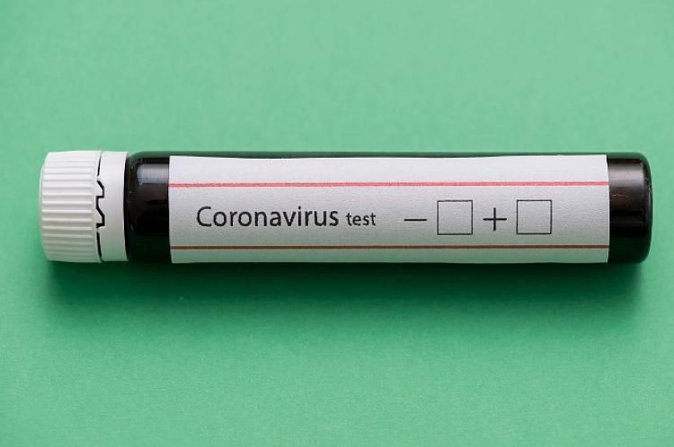 Rusiyada son sutkada koronavirusdan 286 nəfər ölüb
