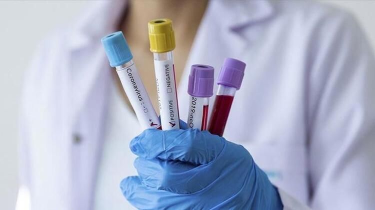 Rusiyada koronavirus son sutkada 303 nəfəri öldürüb
