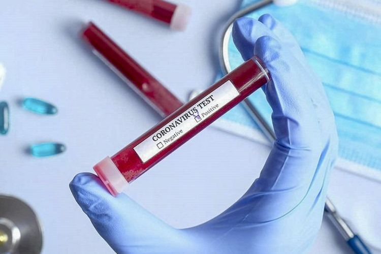 Rusiyada son sutkada koronavirusdan 442 nəfər ölüb