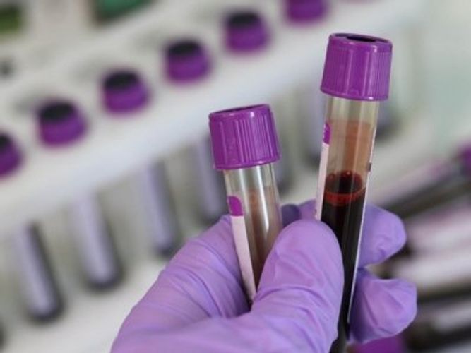 Gürcüstanda koronavirusdan daha 37 nəfər öldü