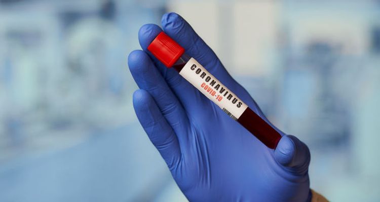 Koronavirus ABŞ-da bir sutkada 2 mindən çox adamı öldürüb