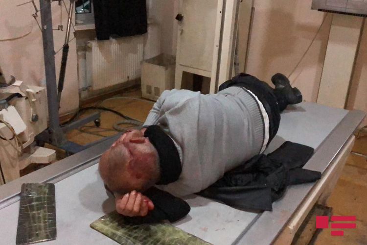 Xalq artistinin qardaşı özünü maşının altına atdı - FOTO