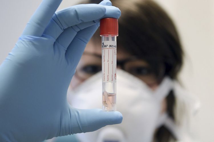 Gürcüstanda son sutkada 4 472 nəfər koronavirusa yoluxub, 34 nəfər ölüb