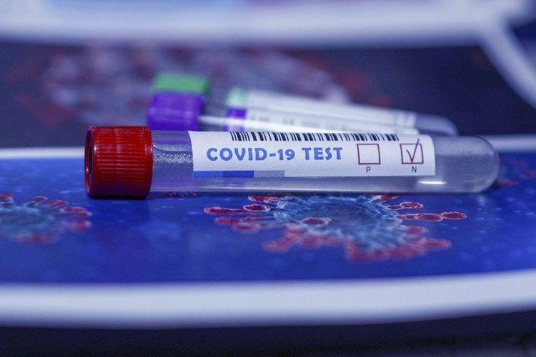 İranda ötən sutkada koronavirusdan 391 nəfər öldü