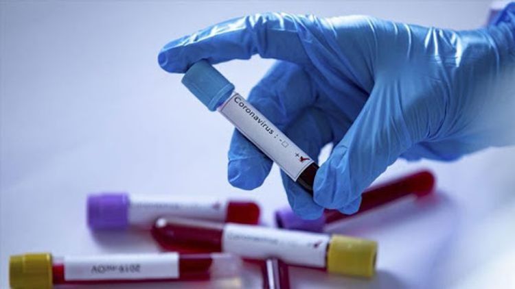 Rusiyada bir sutkada 232 nəfər koronavirusdan ölüb