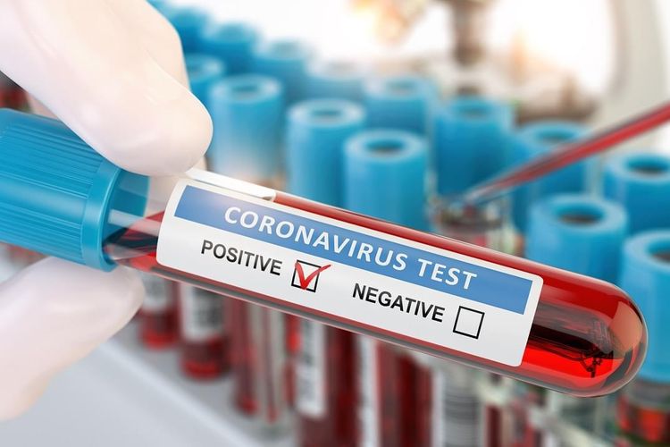 Gürcüstanda koronavirusdan ölənlərin sayı 8 nəfər də artdı