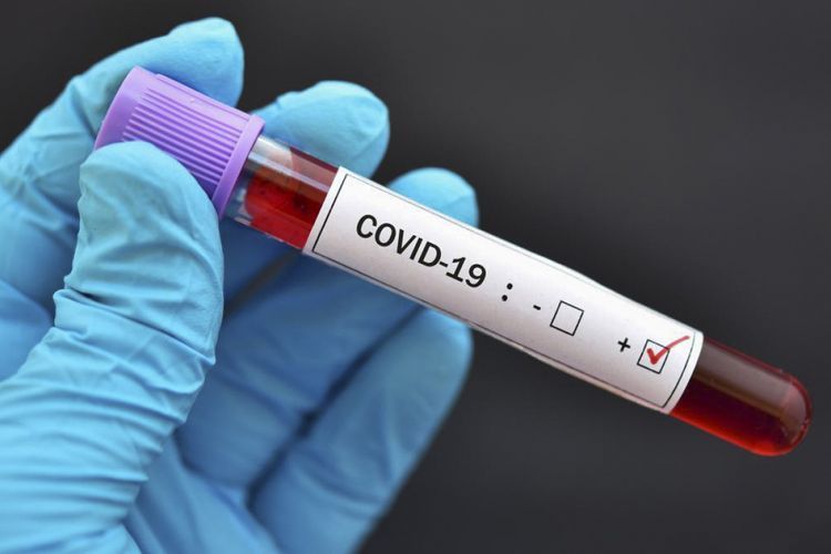 Gürcüstanda koronavirusa daha 1 194 nəfər  yoluxdu: 15 ölüm