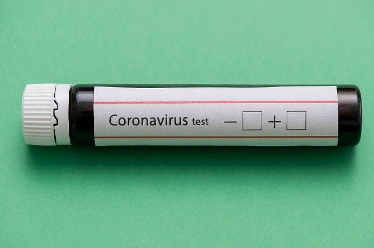 İranda bir sutkada koronavirusdan 312 nəfər ölüb