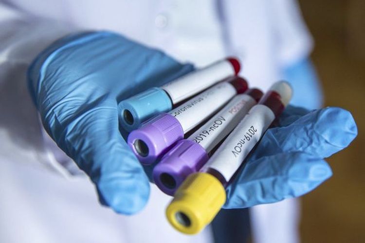 Gürcüstanda son sutkada koronavirusdan 5 nəfər ölüb