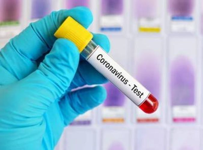 Koronavirus Ermənistanda daha 26 nəfəri öldürdü