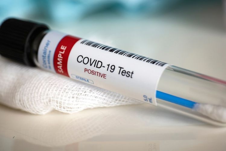 Gürcüstanda koronavirusdan daha 12 nəfər öldü