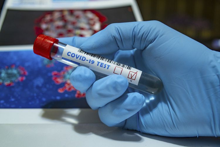 Rusiyadan gələn 33 nəfərdə koronavirus aşkarlandı - RƏSMİ