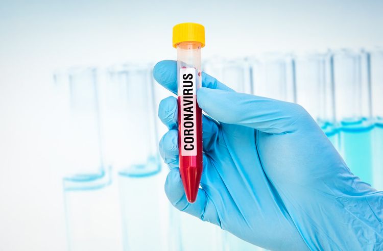 Rusiya əhalisinin 0,6 faizində koronavirus təsdiqlənib
