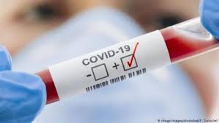 Koronavirus Ermənistanda daha 3 nəfəri öldürdü