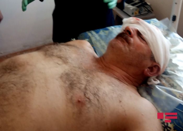 Ermənilərin mərmi atəşi nəticəsində kənd sakini başından yaralandı - FOTO