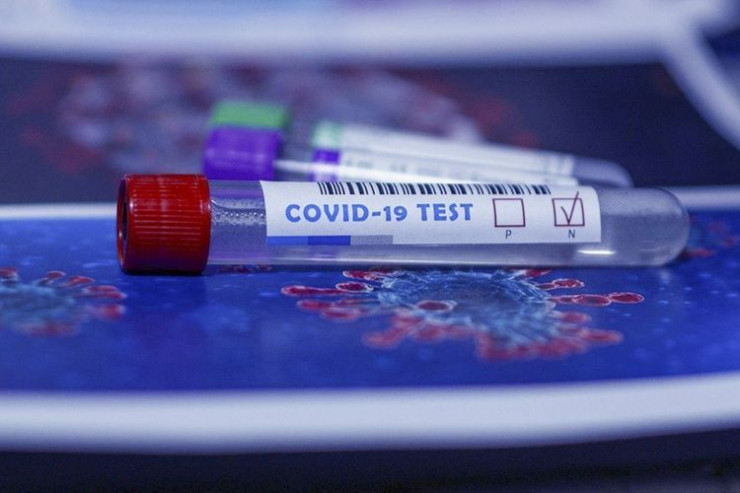Bakıda 5 müəllim və 1 uşaqda koronavirus aşkarlandı
