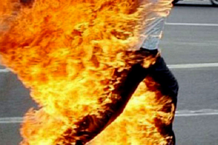 Özünə od vuran kişini xilas edən  POLİSLƏRİN ƏLLƏRİ YANDI 