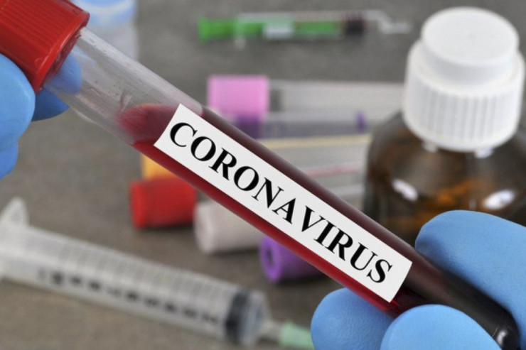 Koronavirusla bağlı   SON STATİSTİKA  