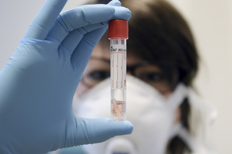Koronavirusdan daha 22 nəfər öldü - SON STATİSTİKA 