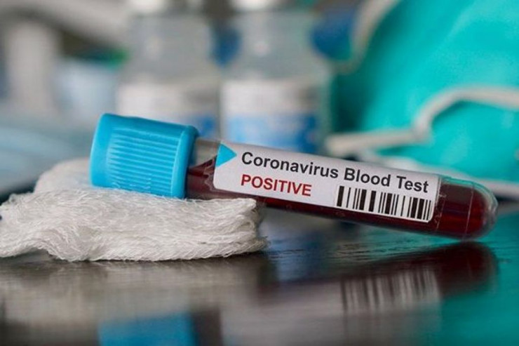 Koronavirusa yoluxma 2300-ü keçdi -  SON STATİSTİKA 