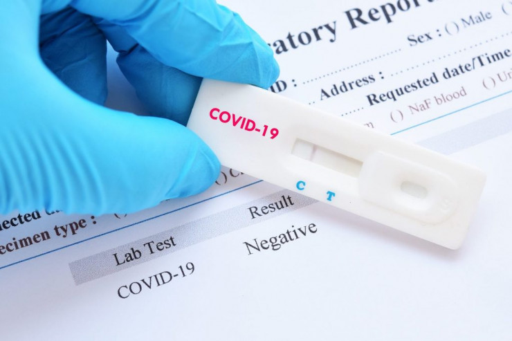 COVID-19-un  qorxulu riskini   müəyyənləşdirəcək test