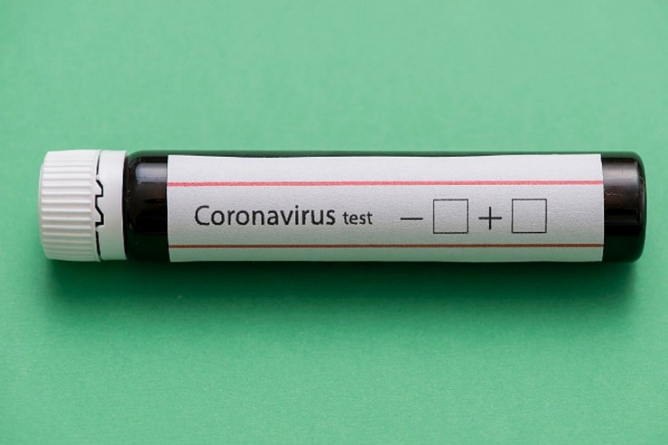 Azərbaycanda rayon məktəbi koronavirusa görə bağlandı