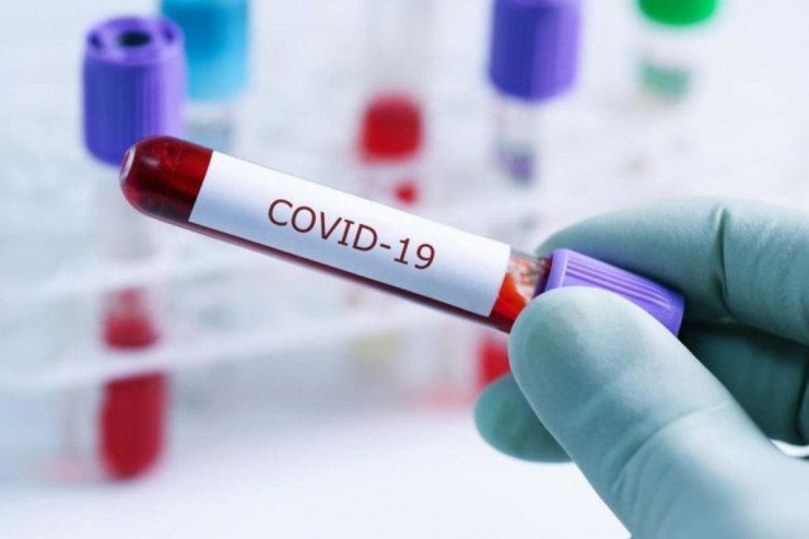 3 həftəlik uşaq koronavirusdan öldü