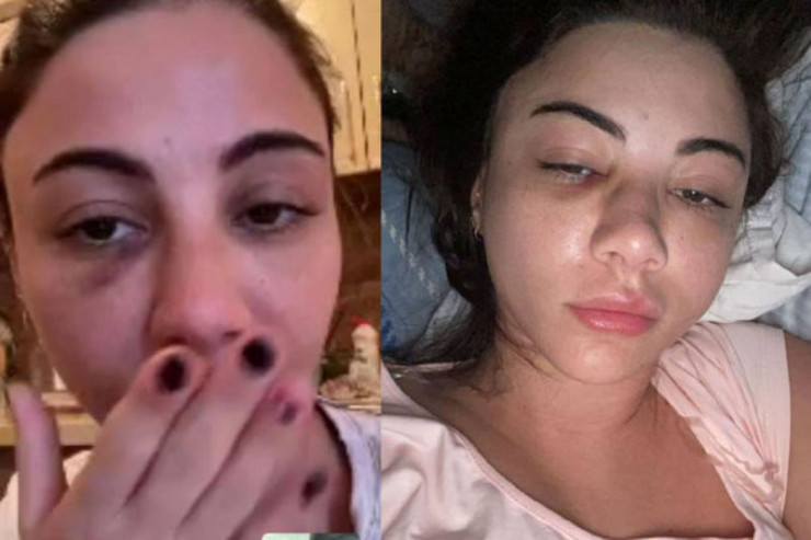 Aysel Əlizadə ağır qəzaya düşdü - FOTO 