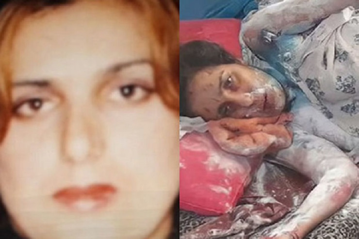 Qayınatası tərəfindən üzünə “kislota” atılan gəlin öldü - VİDEO 