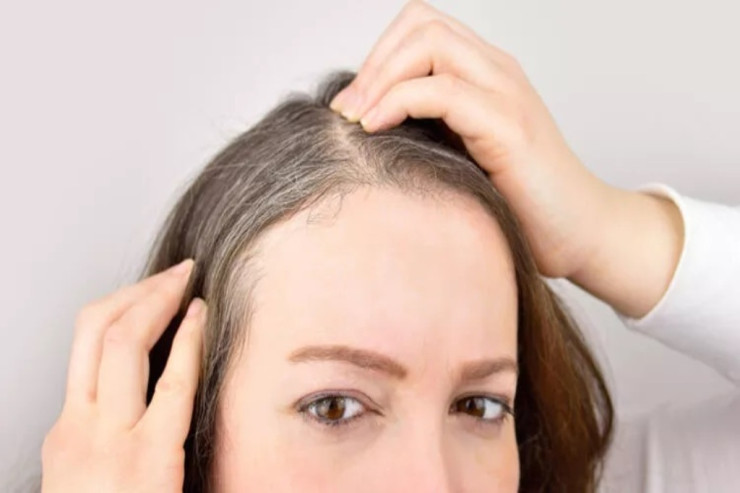 Erkən yaşda saç ağarmasının qarşısını almağın 4 YOLU 