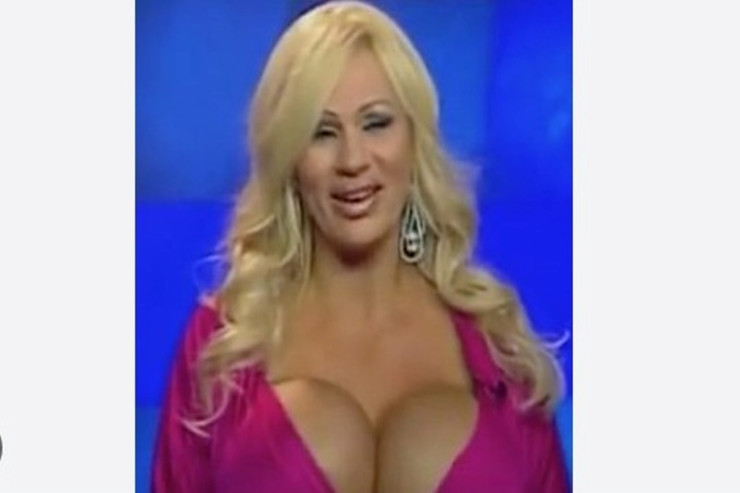 "Barbi"yə oxşamaq üçün 200-ə yaxın əməliyyat keçirdi 