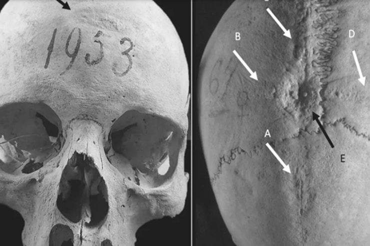 Zorakılığa  məruz qalmış qadının kəlləsi tapıldı – 7-ci əsrlər...  