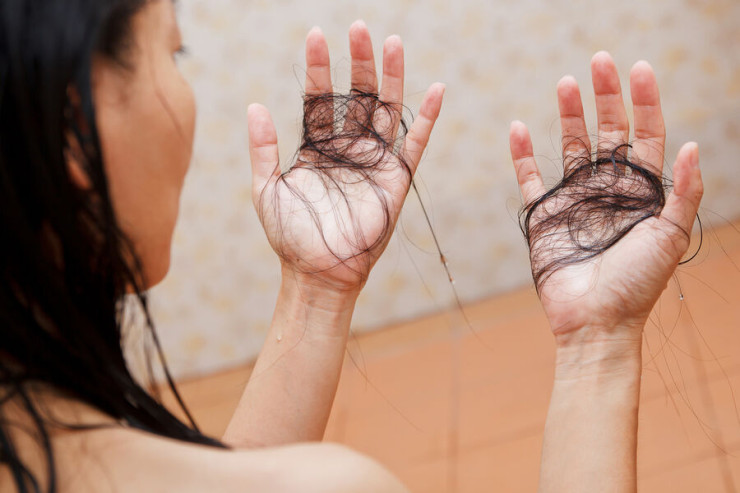 Saç tökülməsinin  əsas səbəbləri AÇIQLANDI