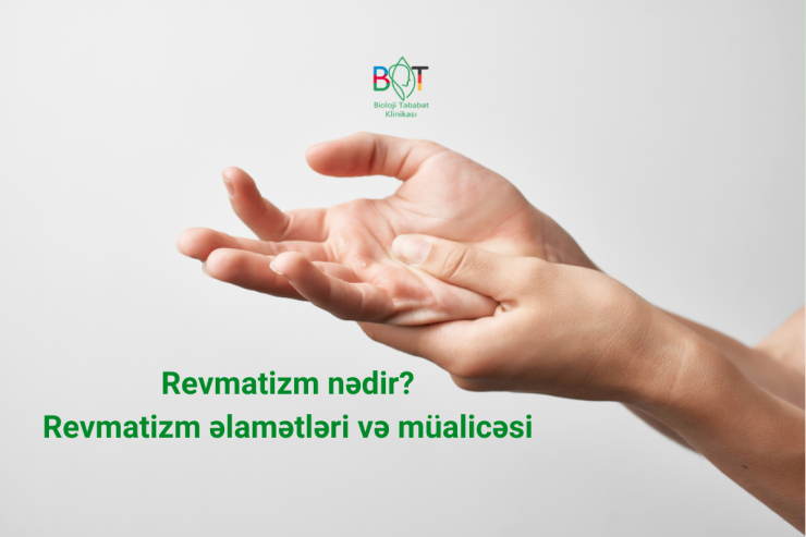  Revmatizm nədir?   Revmatizm əlamətləri və müalicəsi