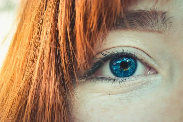 Gözlərdə yüksək xolesterol səviyyəsini necə təyin etmək olar? -   Oftalmoloqdan AÇIQLAMA 