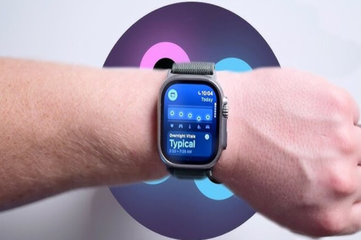 “Apple Watch” xəstəliklər barədə əvvəlcədən xəbər verəcək 