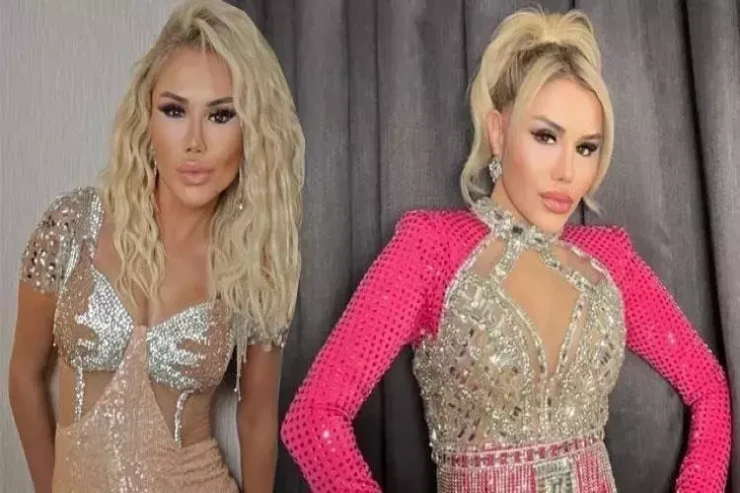 Estetik əməliyyatlar məşhur ifaçını EYBƏCƏRLƏŞDİRDİ