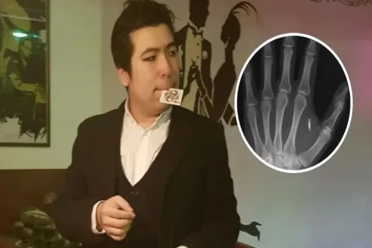 Bioloq alim əlinə yerləşdirdiyi mikroçipin şifrəsini  unutdu