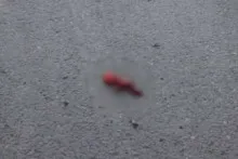 Bakıda xəstəxananın həyətindən döl TAPILDI 