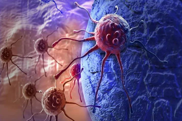 Xərçəngdən ölüm sayı 2050-ci ilə qədər ikiqat artacaq -  Araşdırma 