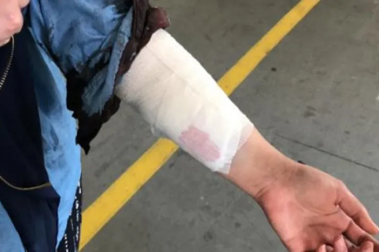 Salyanda kişi qısqanc sevgilisini  döyüb dişlədi 