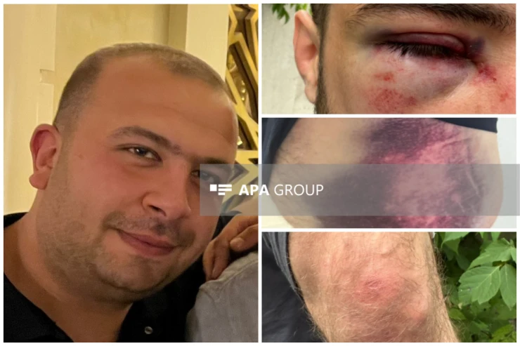 Anama şillə vurdular, atamın qabırğalarını qırıb, bizi 1 saat döydülər - Səfərovlar ailəsi DANIŞDI 