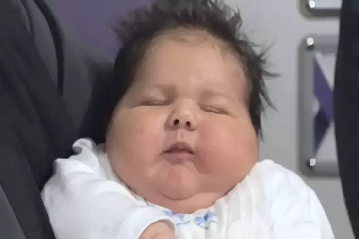 Türkiyədə  nəhəng uşaq   doğuldu