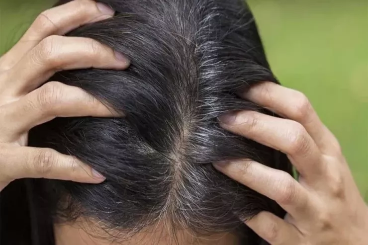 Aqressiv boyalardan  istifadə etmədən ağ saçlardan  xilas olun