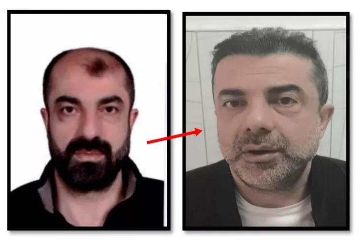 Estetik əməliyyatla 7 il gizləndi,  ölkəyə girən kimi TUTULDU