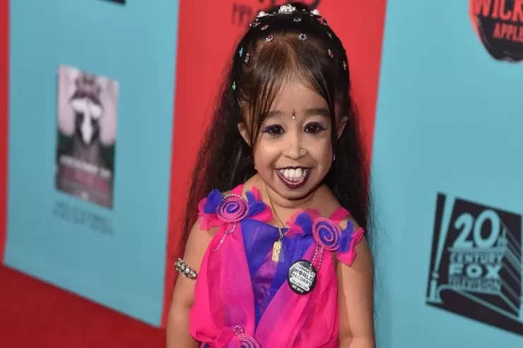 Çəkisi  5,3 kilodur: Dünyanın ən qısaboylu qadını  necə görünür