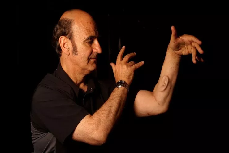 Rəssam əlinə qulaq  implantasiya etdi: O, eşidə  bilir